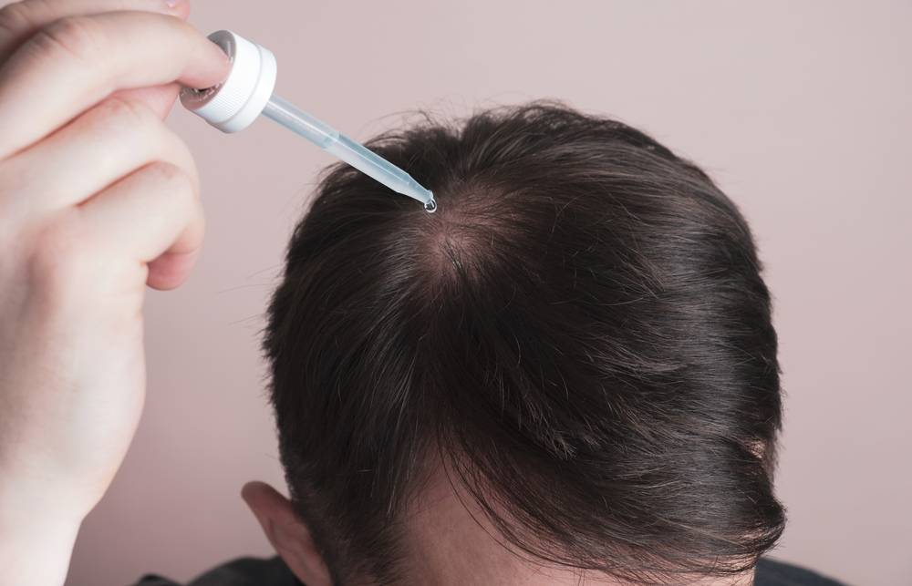 Minoxidil Application