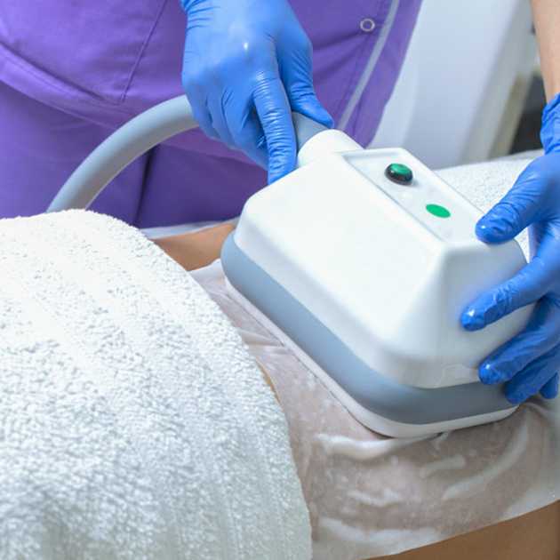 Cryolipolysis sessions