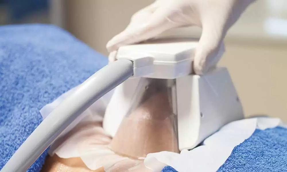 جلسات الكرايو