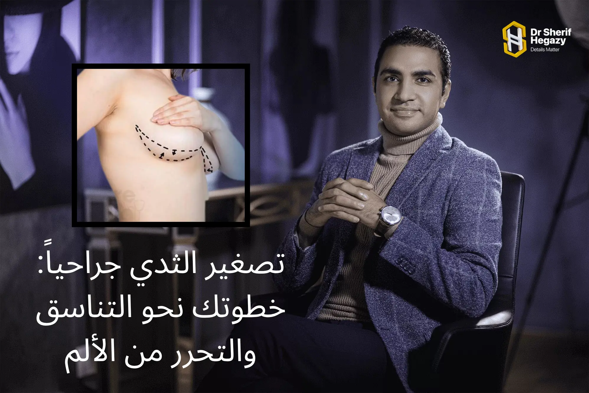 تصغير الثدي