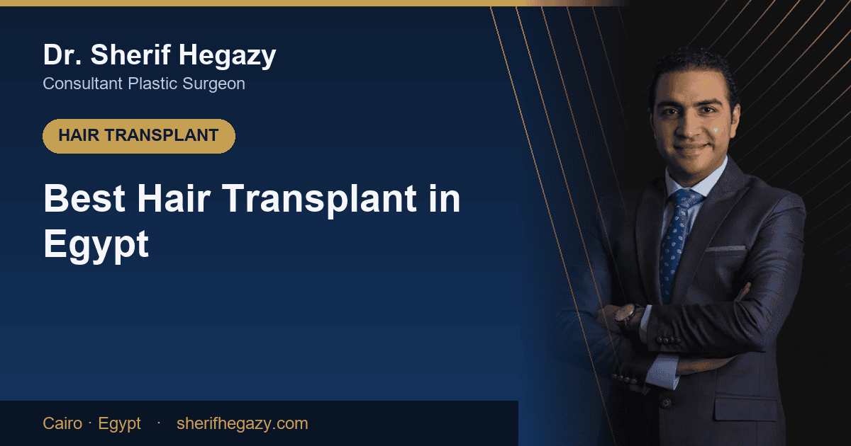 Best hair transplant in Egypt - Dr. Sherif Hegazy