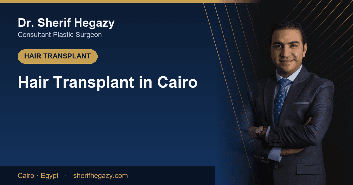 Hair Transplant in Cairo: Where to Go and What to Expect
