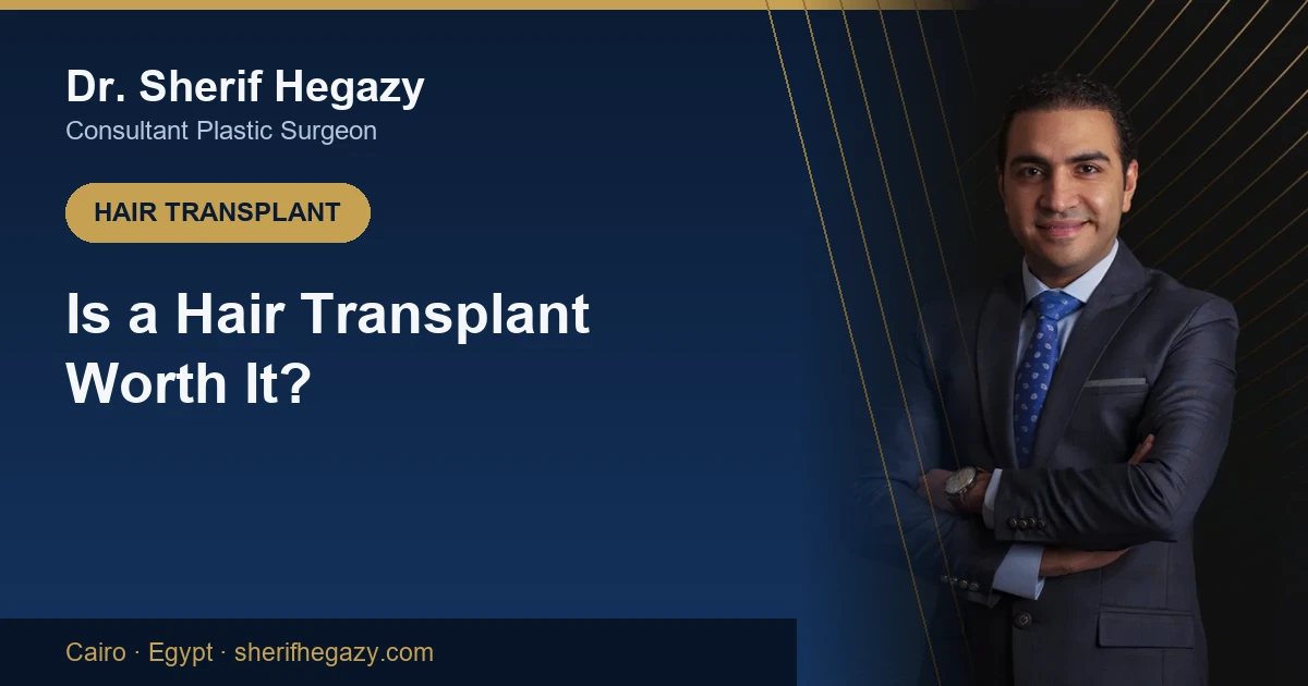 Is a Hair Transplant Worth It? An Honest Answer