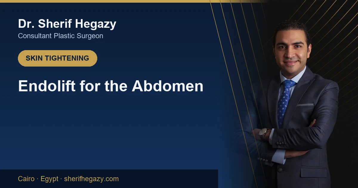 Endolift for the Abdomen: Tighten Without Surgery