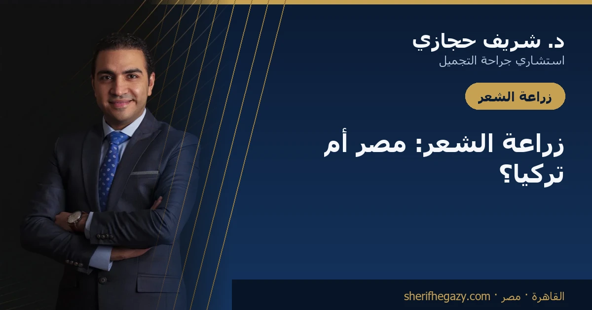 الفرق بين زراعة الشعر في مصر وتركيا: أيهما أفضل؟