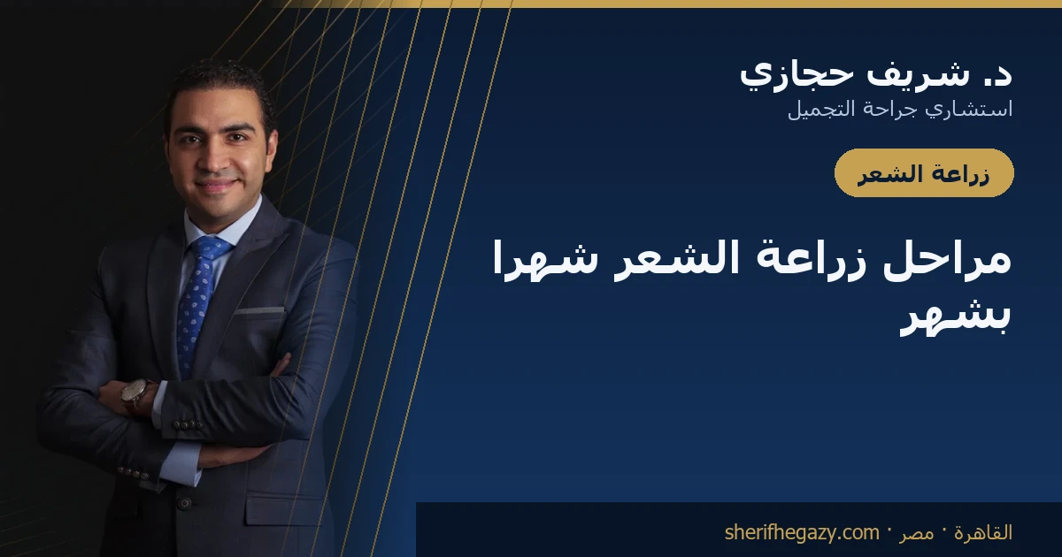 مراحل زراعة الشعر: الجدول الزمني شهراً بشهر