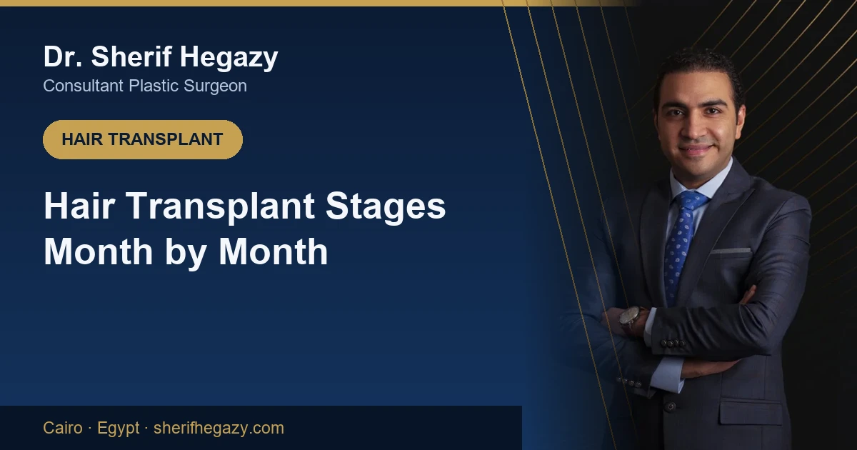 Hair Transplant Stages: The Month-by-Month Timeline