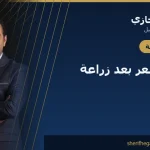 غسل الشعر بعد زراعة الشعر: الروتين الكامل