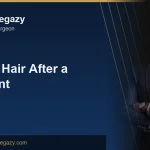 Washing Your Hair After a Hair Transplant: The Full Routine