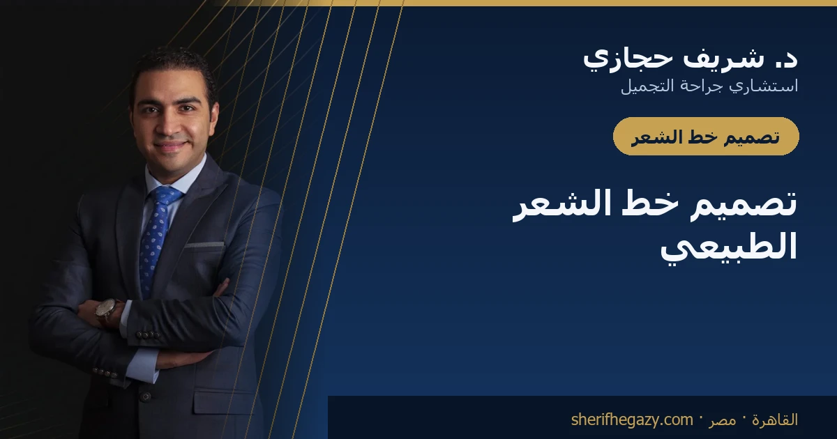كيف يُصمَّم خط الشعر الطبيعي في زراعة الشعر
