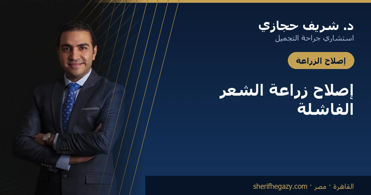 إصلاح زراعة الشعر الفاشلة: ما الذي يمكن تصحيحه وما لا يمكن