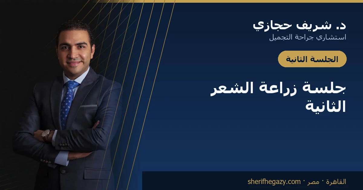 جلسة زراعة الشعر الثانية: متى تكون خطة ومتى تكون إنذاراً