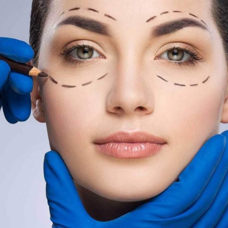 جراحة شد الجفون