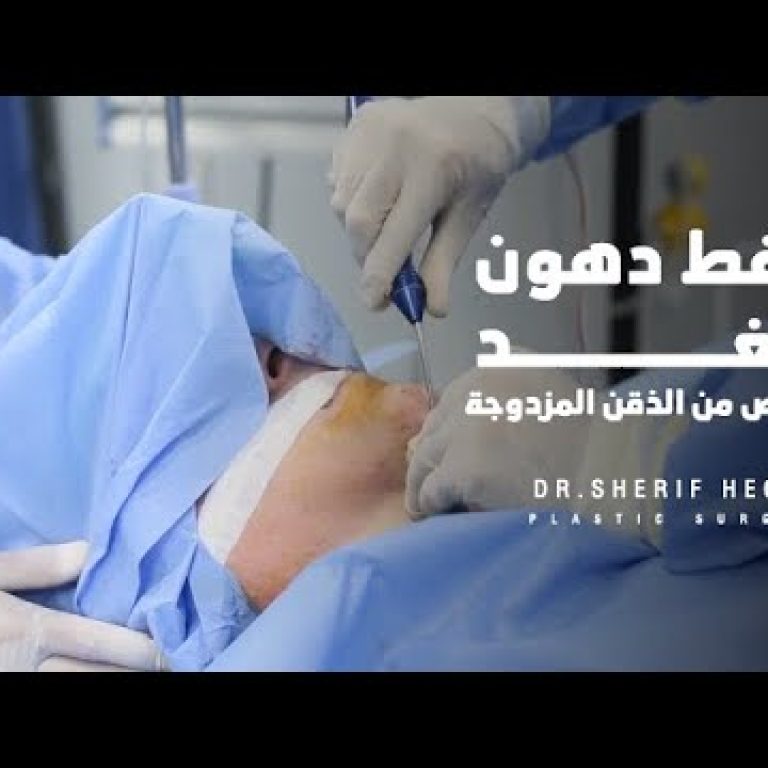 كيفية التخلص من دهون اللغد