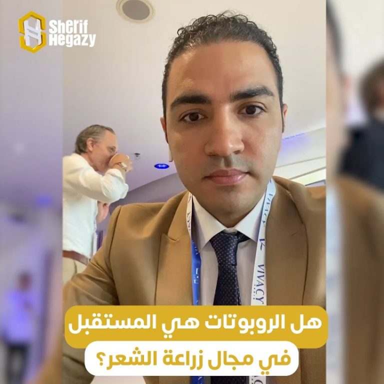 هل الروبتات هي المستقبل في مجال زراعة الشعر ؟