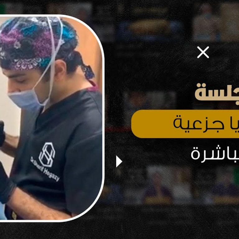 جلسة خلايا جذعية مباشرة