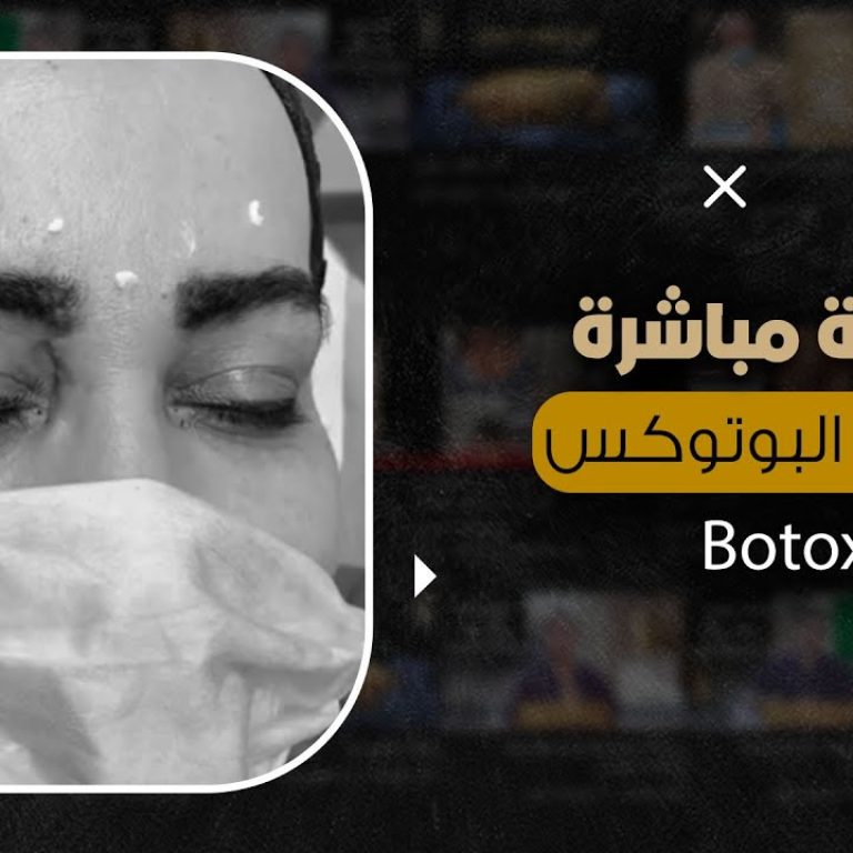 جلسة مباشرة لحقن البوتوكس