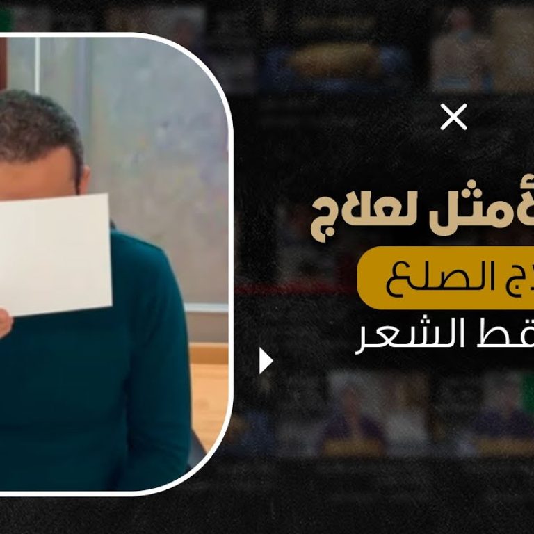 الحل الأمثل لعلاج الصلع وتساقط الشعر