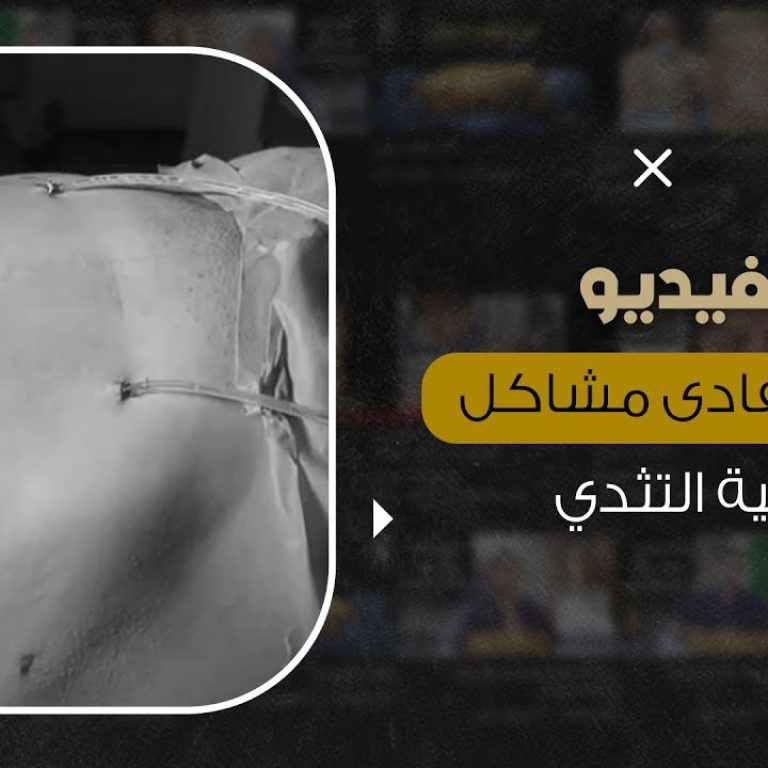 كيف نتفادى مشاكل عملية التثدي