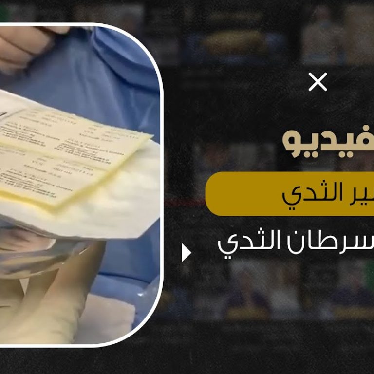 تكبير الثدي وحدوث سرطان الثدي