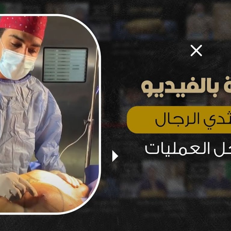 مباشرة علاج التثدي للرجال من داخل العمليات