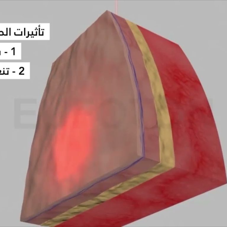 ازاي بيشتغل ؟ - Endolift