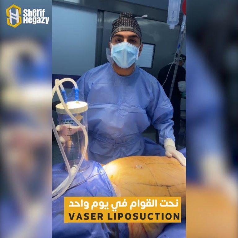 نحت القوام في يوم واحد