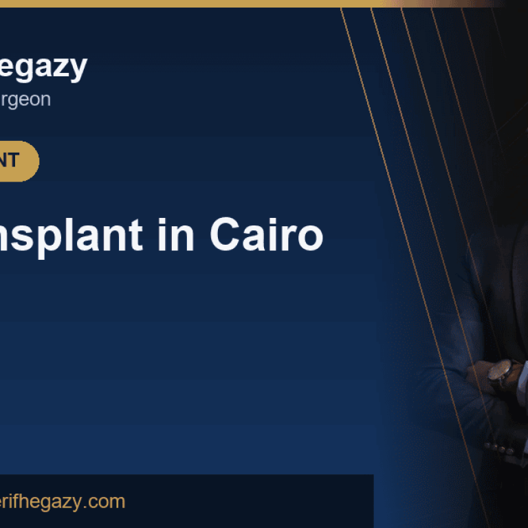 Hair Transplant in Cairo: Where to Go and What to Expect