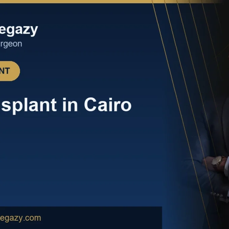 Hair Transplant in Cairo: Where to Go and What to Expect