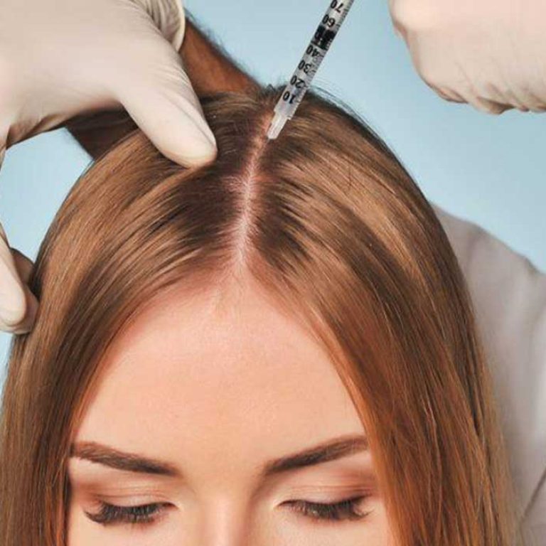 ابر الميزوثيرابي للشعر