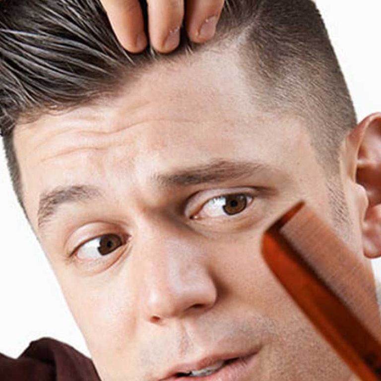اسباب تساقط الشعر عند الرجال