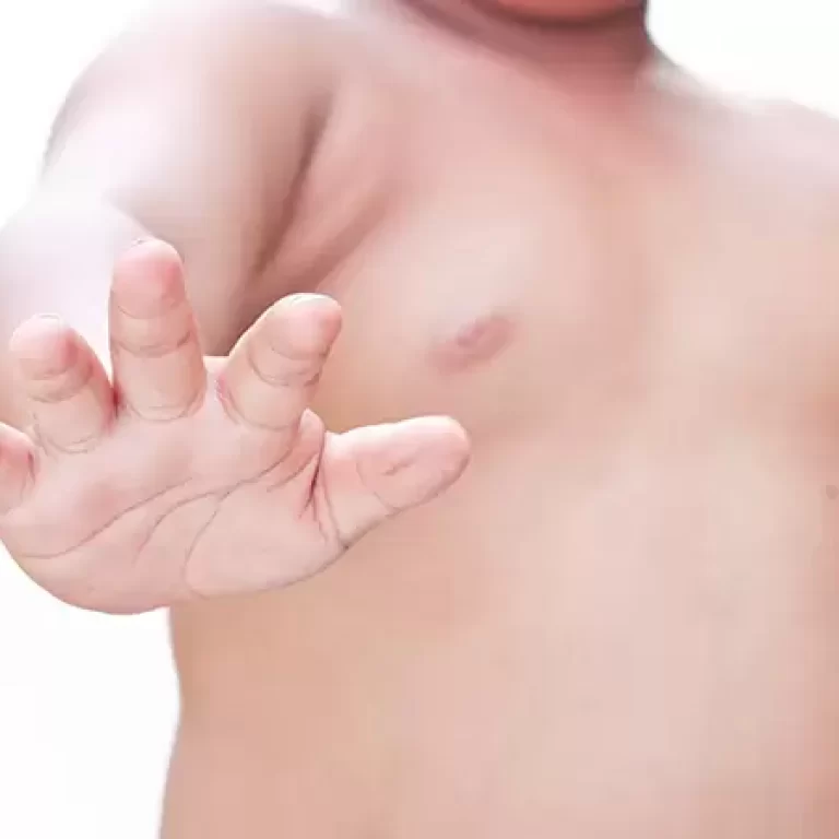 التثدى عند الاطفال