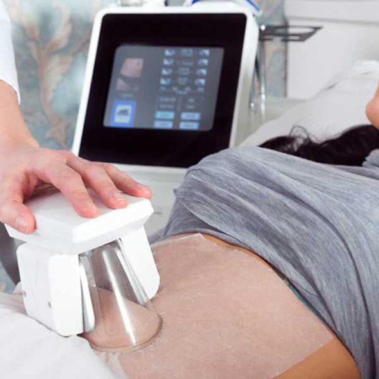 التنحيف بالتجميد