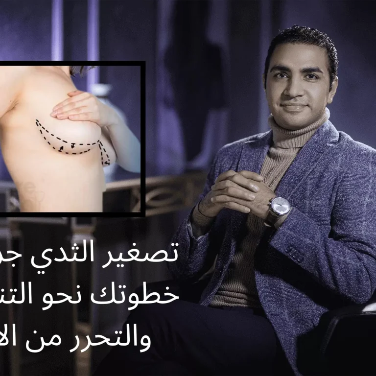 تصغير الثدي