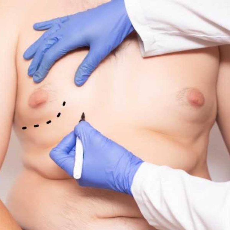 تثدي الرجل الكاذب