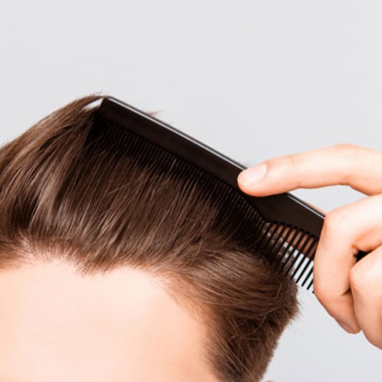 تجربتي مع زراعة الشعر بالصور