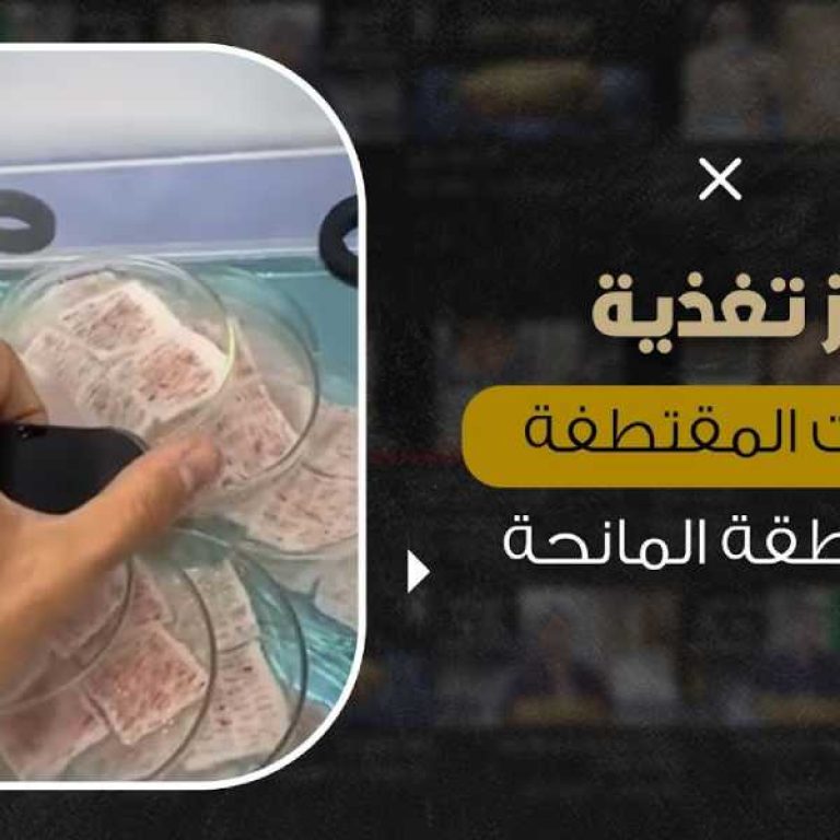 تغذية بصيلات الشعر