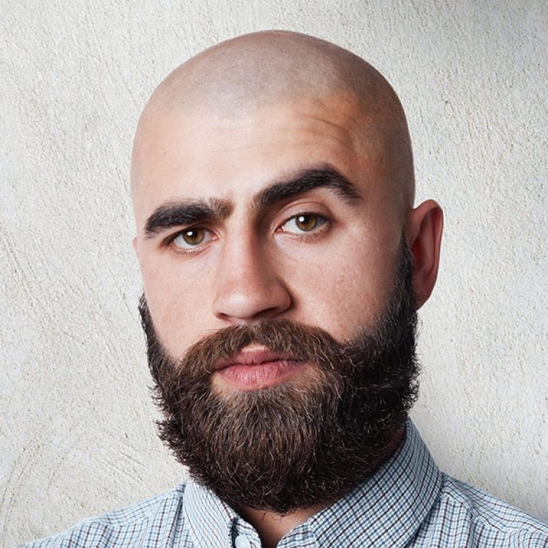 تكاليف زراعة الشعر في مصر