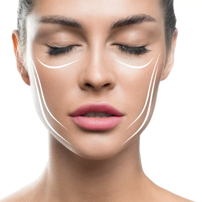 تكلفة عملية تجميل الوجه