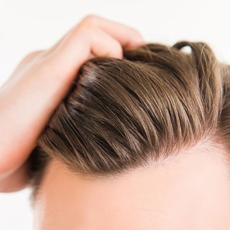 زراعة الشعر بتقنية dhi