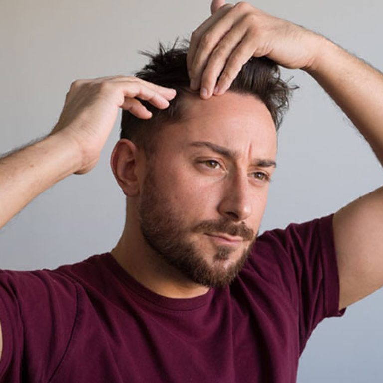 زراعة الشعر بدون حلاقة