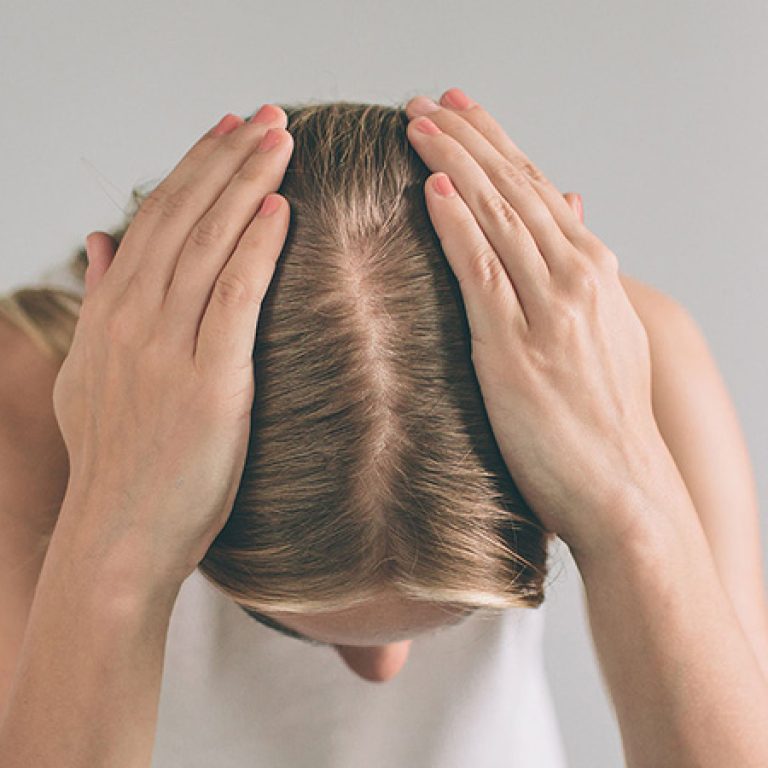 زراعة الشعر للسيدات