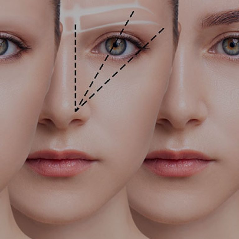 زراعة-شعر-الحواجب