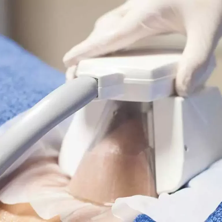 جلسات الكرايو