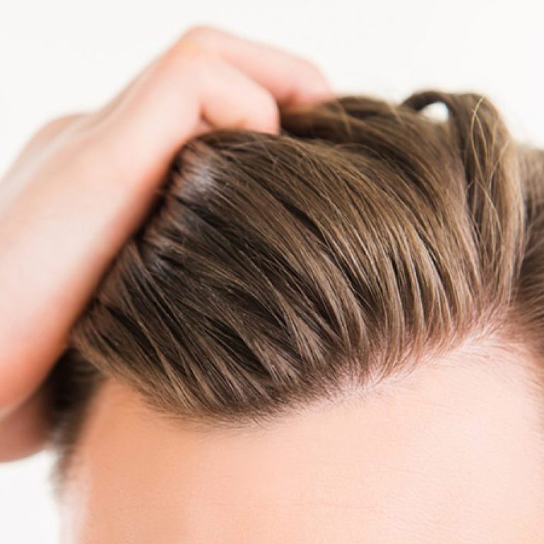 سعر عملية زرع الشعر