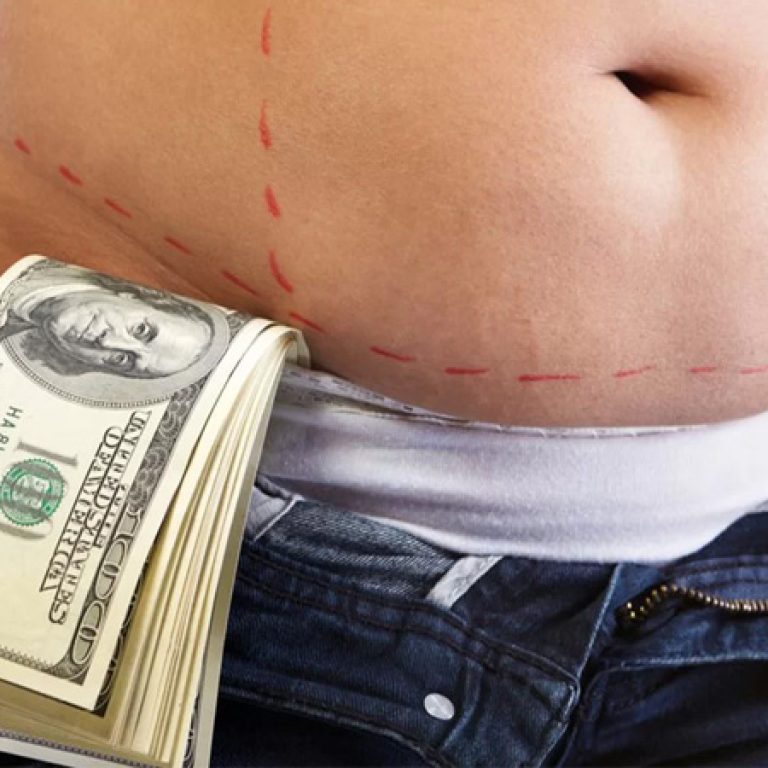 سعر عملية شفط الدهون بالليزر في مصر
