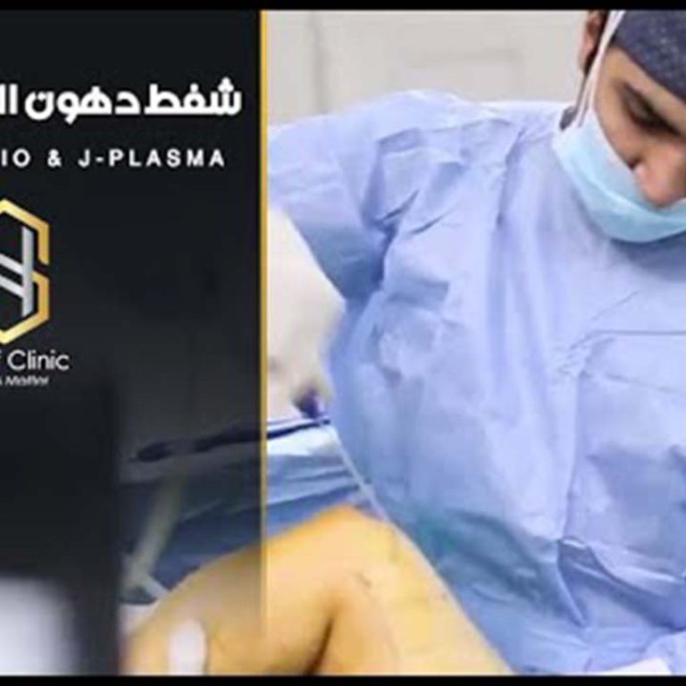 شفط دهون الذراعين واللغد