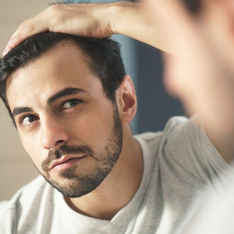 طريقة زراعة الشعر في المنزل