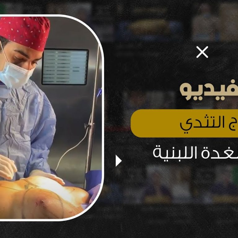 علاج تثدي الرجال