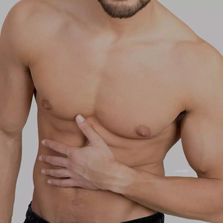 علاج التثدي عند الرجال بالأدوية
